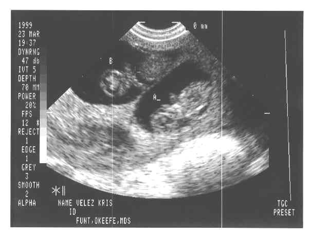 babies-1a.JPG - 21.3 K