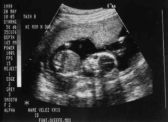 babies-5.JPG - 21.7 K