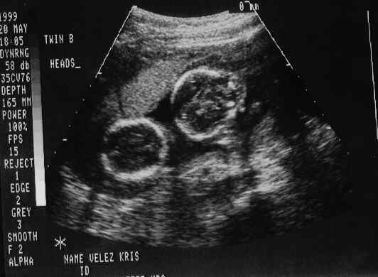 babies-6.JPG - 18.4 K