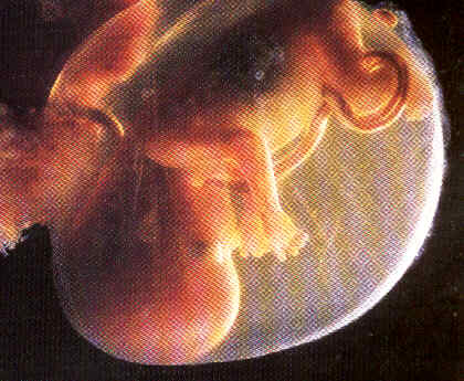 fetus.JPG - 25.2 K