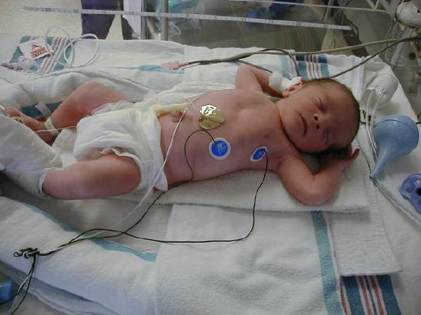 pjv-neo-1.jpg - 42.3 K