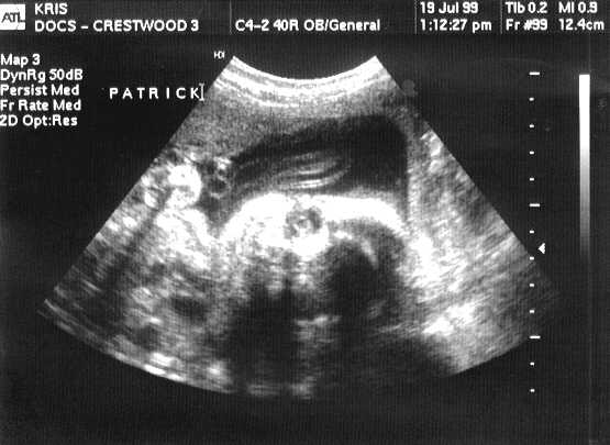 sono-0719-p.JPG - 26.0 K